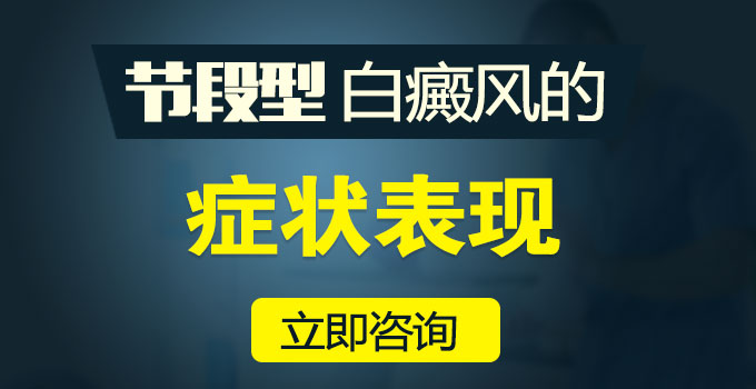 节段型白癜风的症状有哪些?