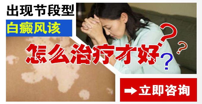出现节段型白癜风该怎么治疗才好呢?