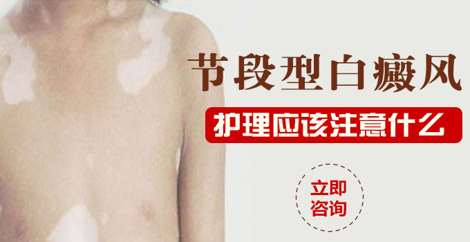 节段型白癜风护理应注意什么呢?