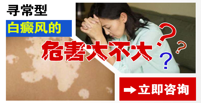 寻常型白癜风的危害大不大?
