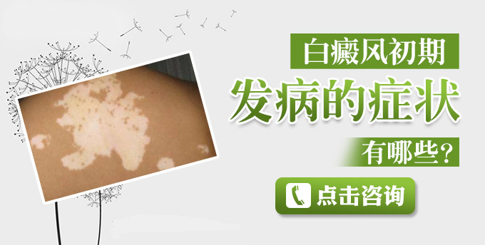 白癜风初期发病的症状有哪些？(图1)