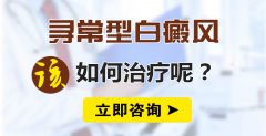 寻常型白癜风该如何治疗呢？