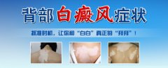 背部白癜风有哪些常见的症状特点呢?