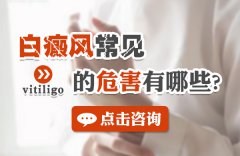 白癜风的常见危害有哪些