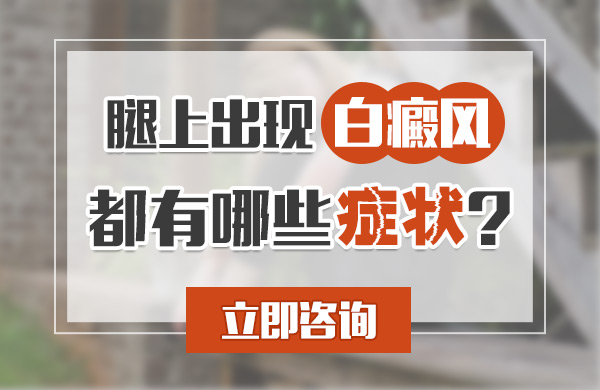 腿上出现白癜风都有哪些症状？