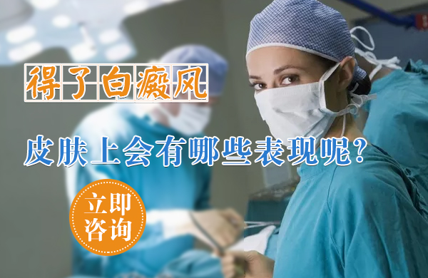 得了白癜风皮肤上会有什么表现？