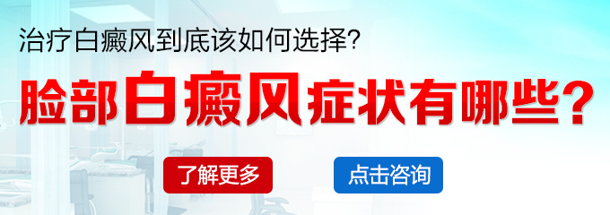 脸部白癜风症状有哪些?(图1)