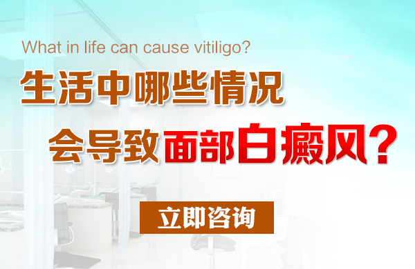 患面部白癜风的原因都有哪些?(图1)