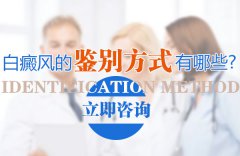 白癜风的鉴别方式有哪些？