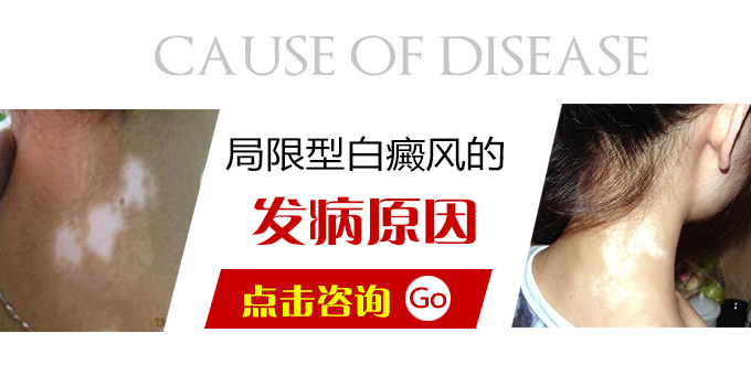 局限型白癜风的发病原因是什么？(图1)
