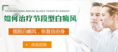 出现节段型白癜风应该怎么治疗才好?