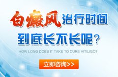 白癜风的治疗时间到底长不长？